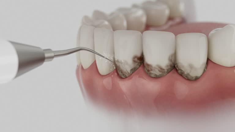 Reliable Dental Implants contractor in Diamond Bar, CA by Smile Center Dentistry